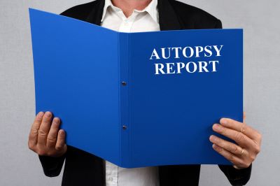 autopsy report - Jewish Funeral Services, Serving South East Florida a man in a white dress shirt with a black jacket holding a blue folder with white letters that read "Autopsy Report"
